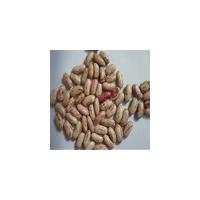 Large picture light speckled kidney beans
