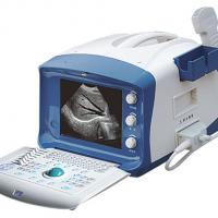 Large picture B-type Ultrasound Scanner