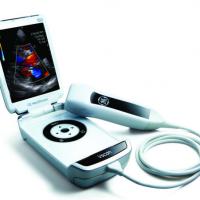 Large picture GE V-Scan ultrasound