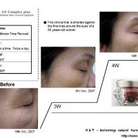 Large picture clinical pics of EGF Revived Capsules