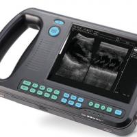 Large picture Palmtop Digital Ultrasound Scanner