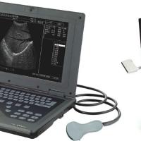 Large picture Digital Notebook Ultrasound Scanner