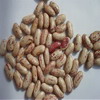 light speckled kidney beans