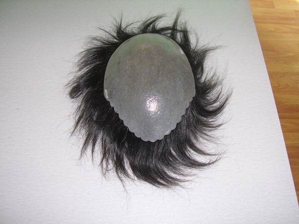 injection toupee