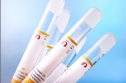 Serum UIT GEL Tube - Vacuum Blood Collection Tube