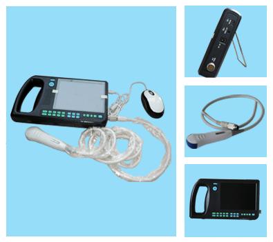 Digital PalmSmart Uitrasound Scanner