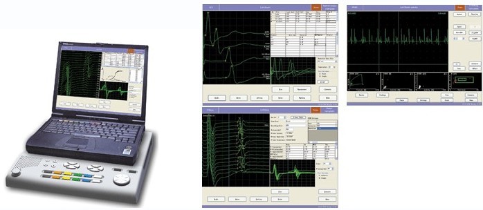 EMG/EP System