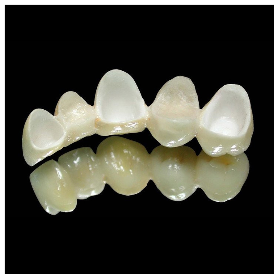 Dental Zirconia all ceramic aesthetic crown