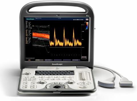 Color Doppler