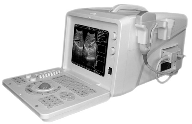 Portable Ultrasound Scanner