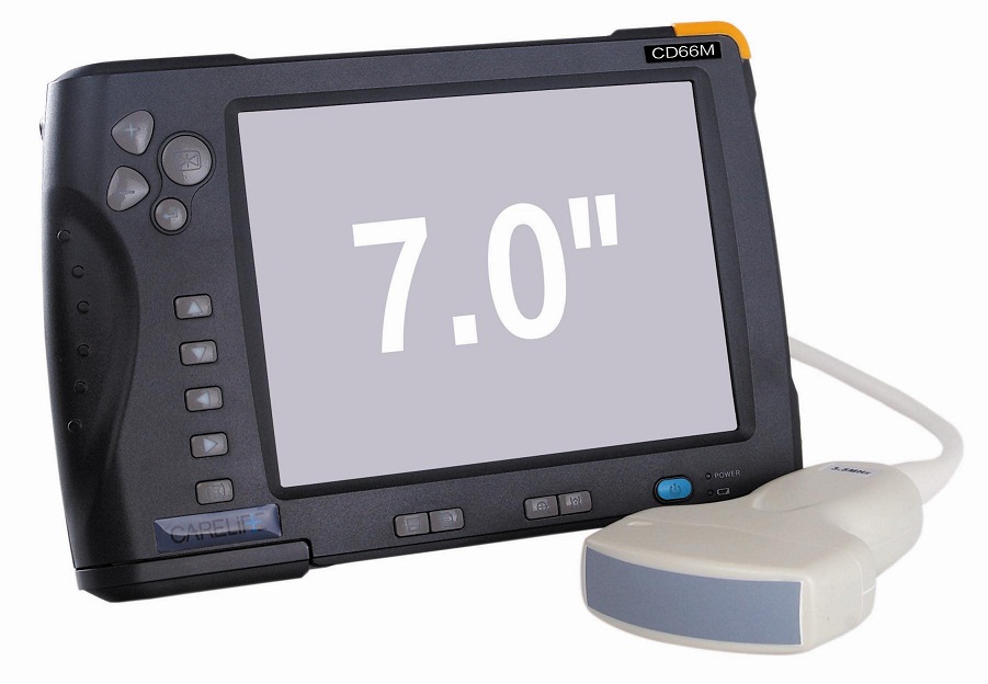 7'' Digital Ultrasound Scanner
