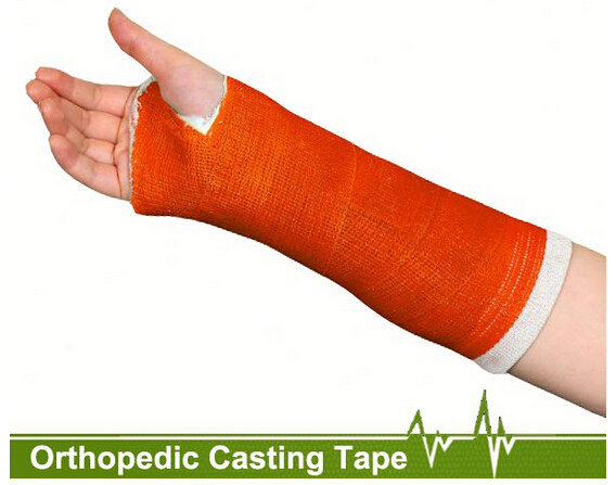orthopedic fiberglass casting tape