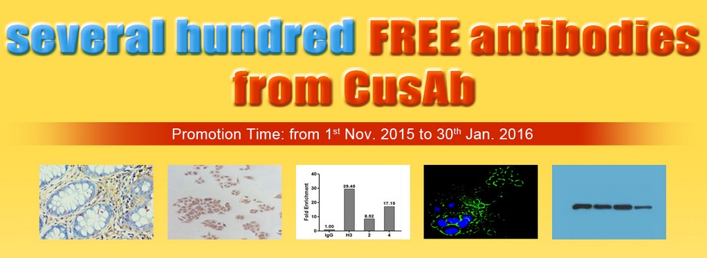 ATG2B Antibody