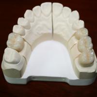 Large picture Dental IPS E.max all ceramic Crown and bridge