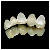 Large picture Dental Zirconia all ceramic aesthetic crown