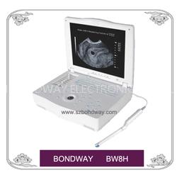 Laptop/Portable Ultrasound Scanner