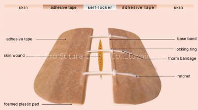 Synthetic absorbable suture