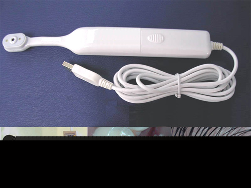 Dental Camera Microscope