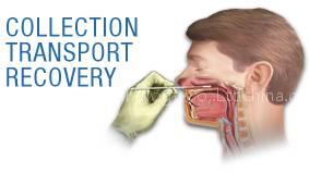 Nasopharyngeal Flocked Swabs